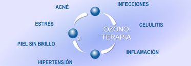 ozono